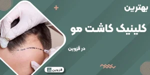 بهترین کلینیک کاشت مو قزوین